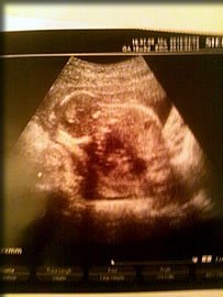 16週目のエコー