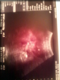 ボヤけて見ずらいけど☆