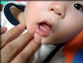 歯が生えたーー