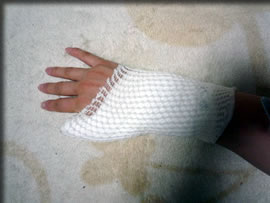 痛々しい・・ってか痛い！